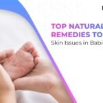 Top Natural Remedies to Heal Skin Issues in Babies